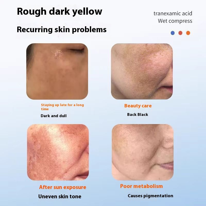 Coagulation Acid Tranexamic Acid Wet Compress Nursing Solution